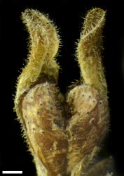 Veronica spectabilis. Old capsule and calyx (two lobes removed). Scale = 1 mm.
 Image: P.J. Garnock-Jones © Te Papa CC-BY-NC 3.0 NZ